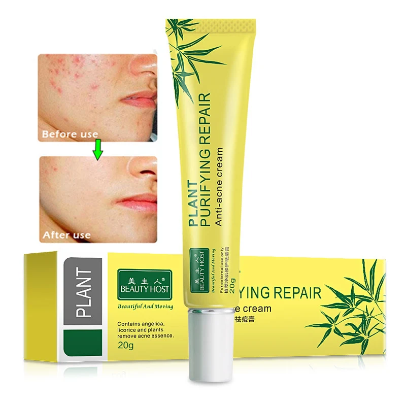 3 шт./лот оригинальный крем для лечения акне шрамов от быстрое очищение прыщей