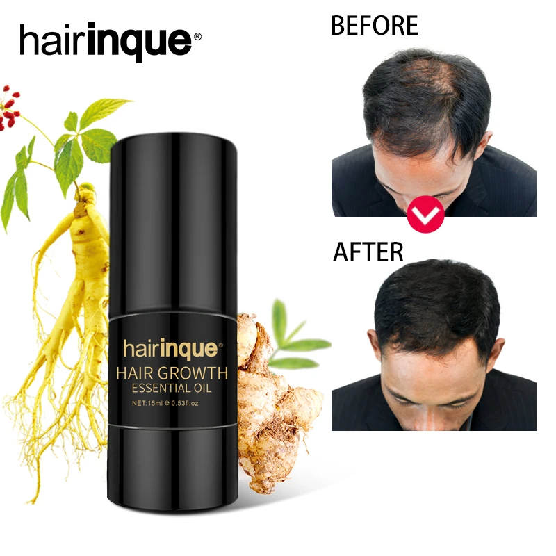 Hairinque 15 мл экстракт имбиря эссенция для роста волос масло предотвращает выпадение волос поддерживает здоровый рост волос уход за волосами масло 3,28