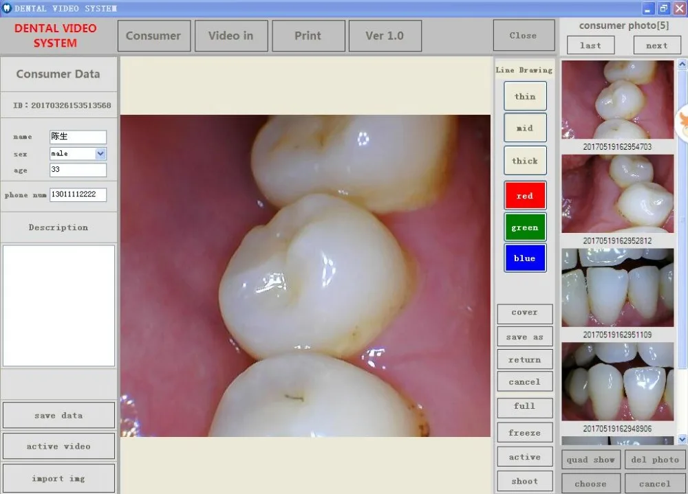 Intraoral камера 17 дюймов Intel Celeron сенсорный экран монитор все в одном ПК AJ-010B