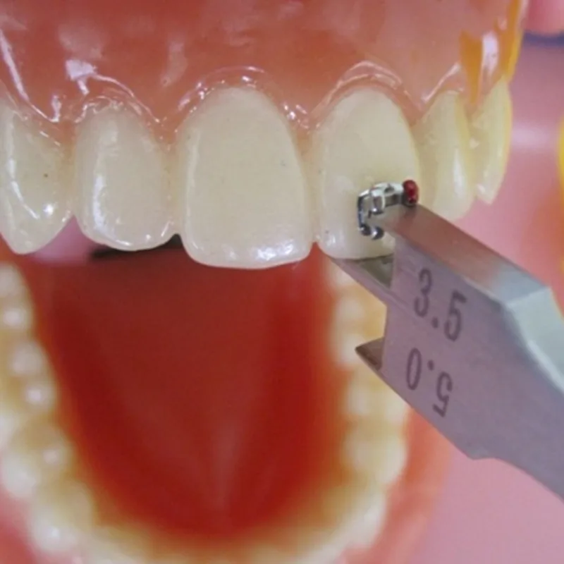 3 шт. кронштейн-локатор | Красота и здоровье