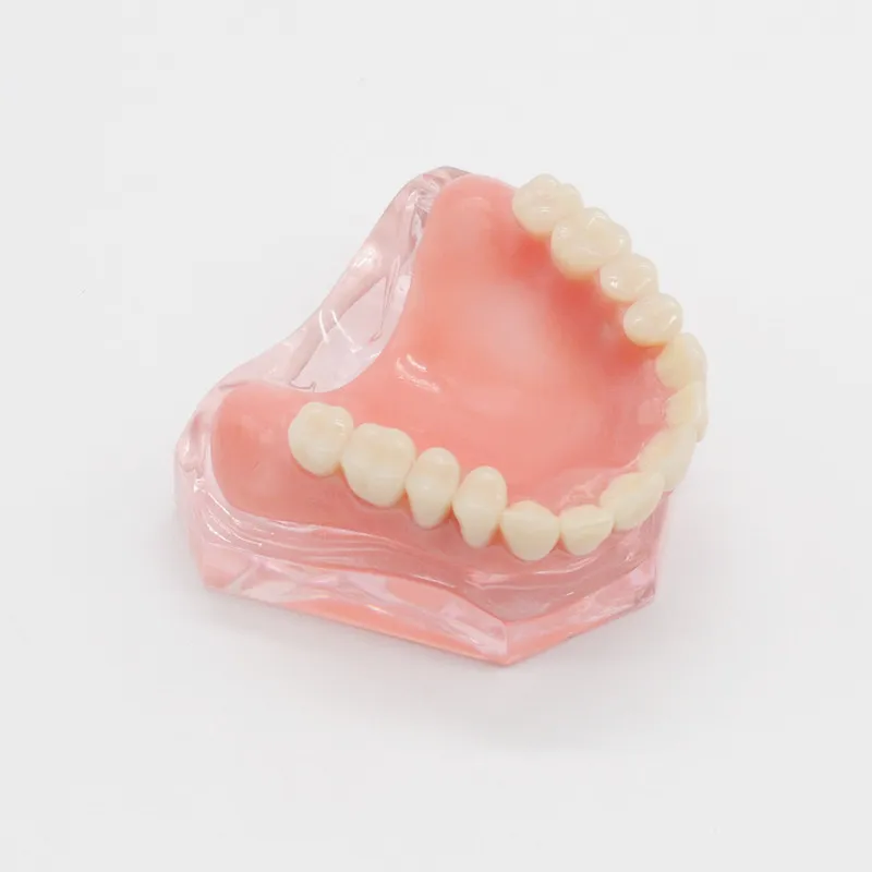 Dentist Overdenture Upper Anterior Maxillary 4 Implants Restoration Teeth Model For Dentistry Lab | Красота и здоровье