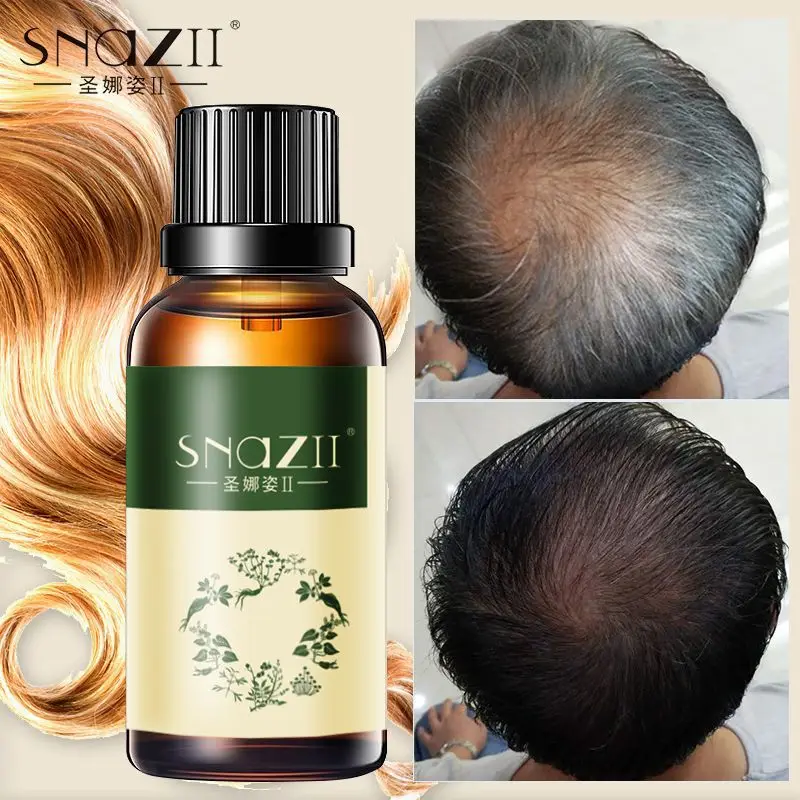 

Best effect hair Shampoo oil and conditioner for hair growth and hair loss prevents premature thinning hair for men and women