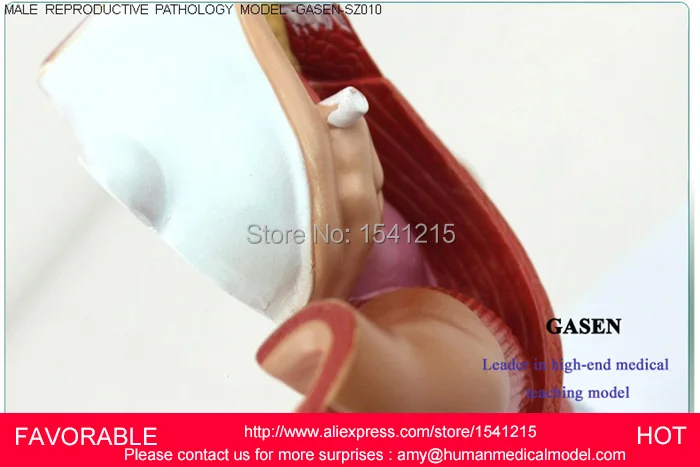 Модель мужской репродуктивной системы Анатомия продукт репродукции Мужской