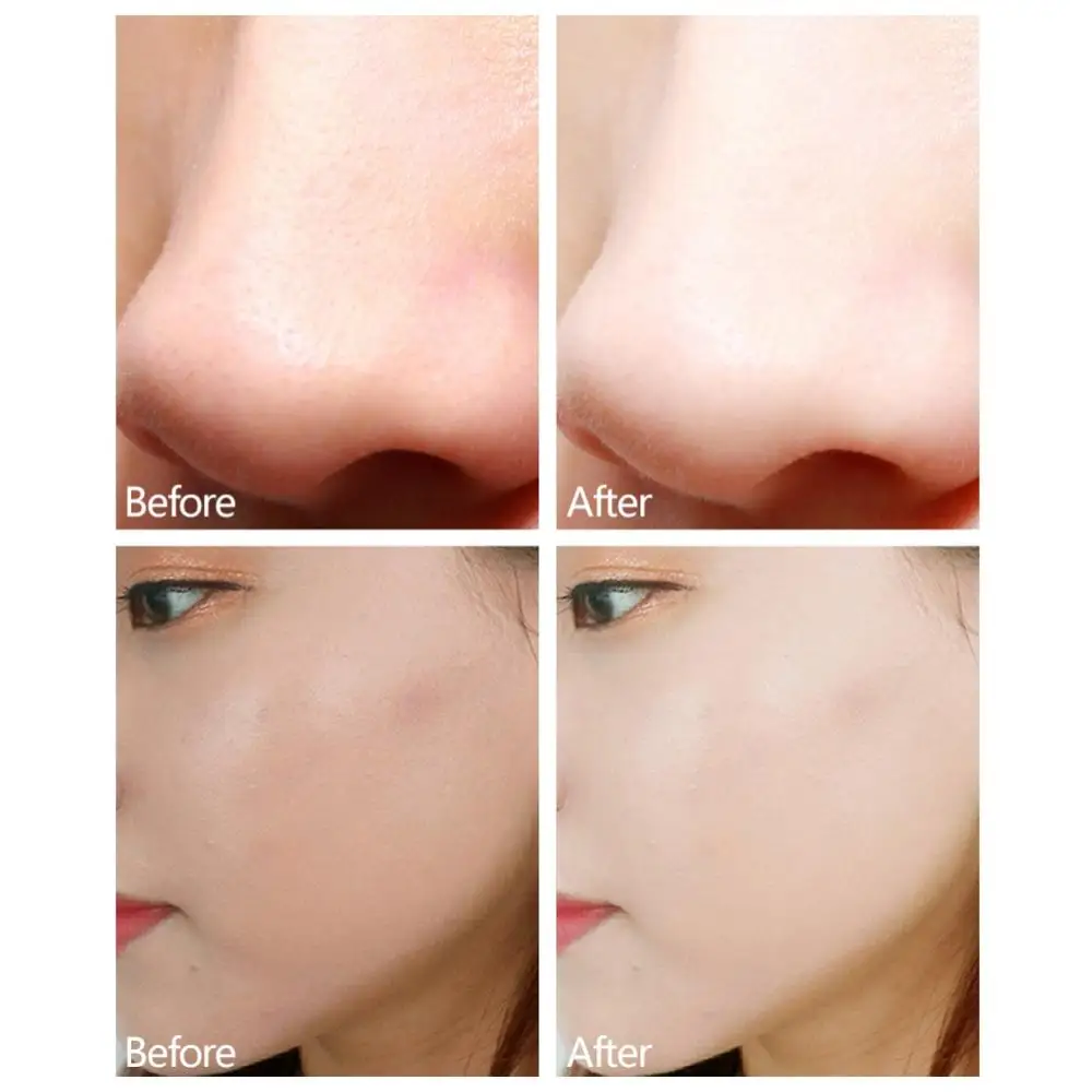 Крем для массажа лица увлажняющий с контролем жирности удаление черных точек