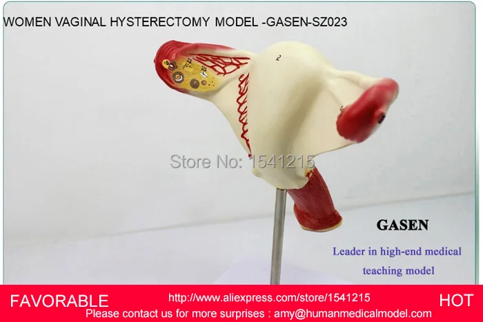 Модель матки модель генитальной анатомии учебная медицинская планирования