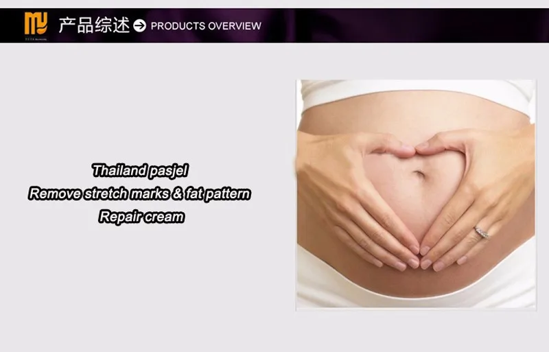 

100 PCS Pasjel Cream Anti Stretch Marks And Scar Removal To Stretch Marks Obesity Pattern Maternity Skin Body Repair Crea