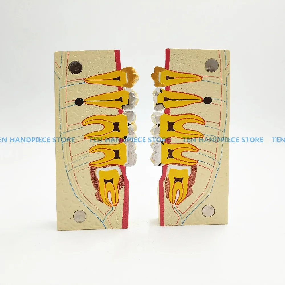 

2018 new Dental teeth model Lower right posterior teeth tissue decomposition model Doctor - patient communication model magnetic