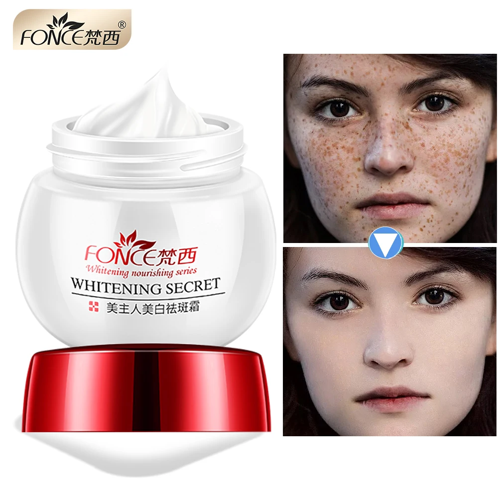 

Korea Strong effect Whitening Cream Face Remove Freckles Reduces Age Spots Fade Dark Spot treatment Stain Facial Serum 30g