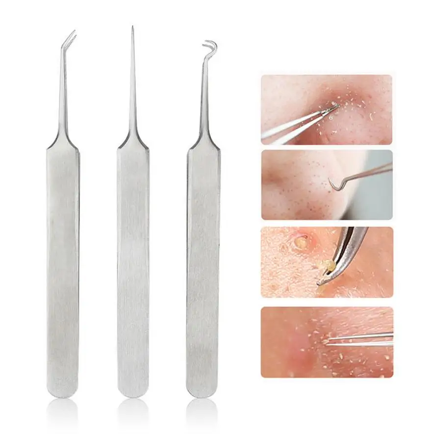 

3PC Bend Curved Stainless Steel Whitehead Blackhead Acne Clips Pimple Comedone Remover Face Cleaner Needles Tool JU054