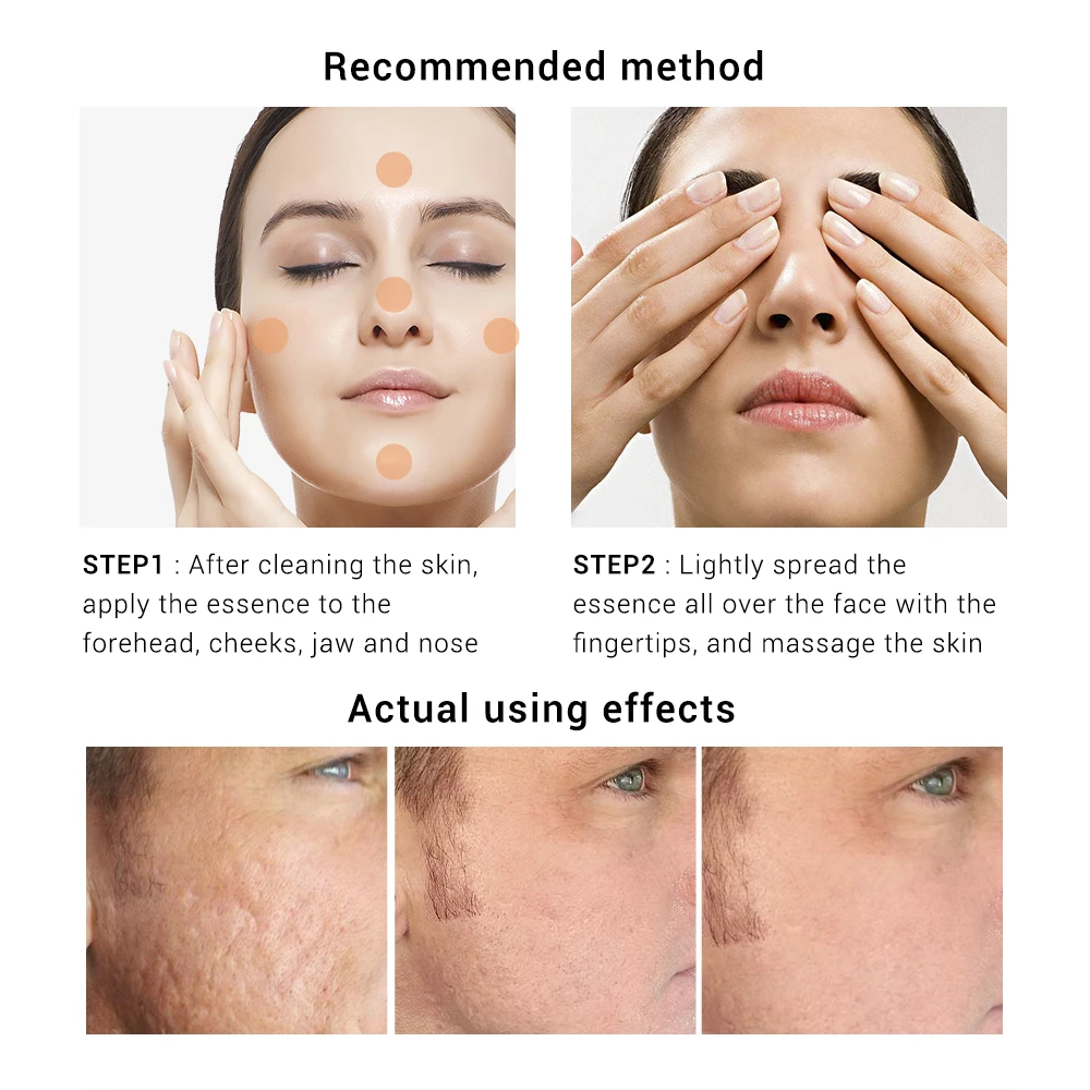 

LANBENA 24K Gold+Silver Silk +Gold Silk Collagen Ampoule Serum Anti-Aging Lighten Spots Moisturizing Whitening Firming Skin Care