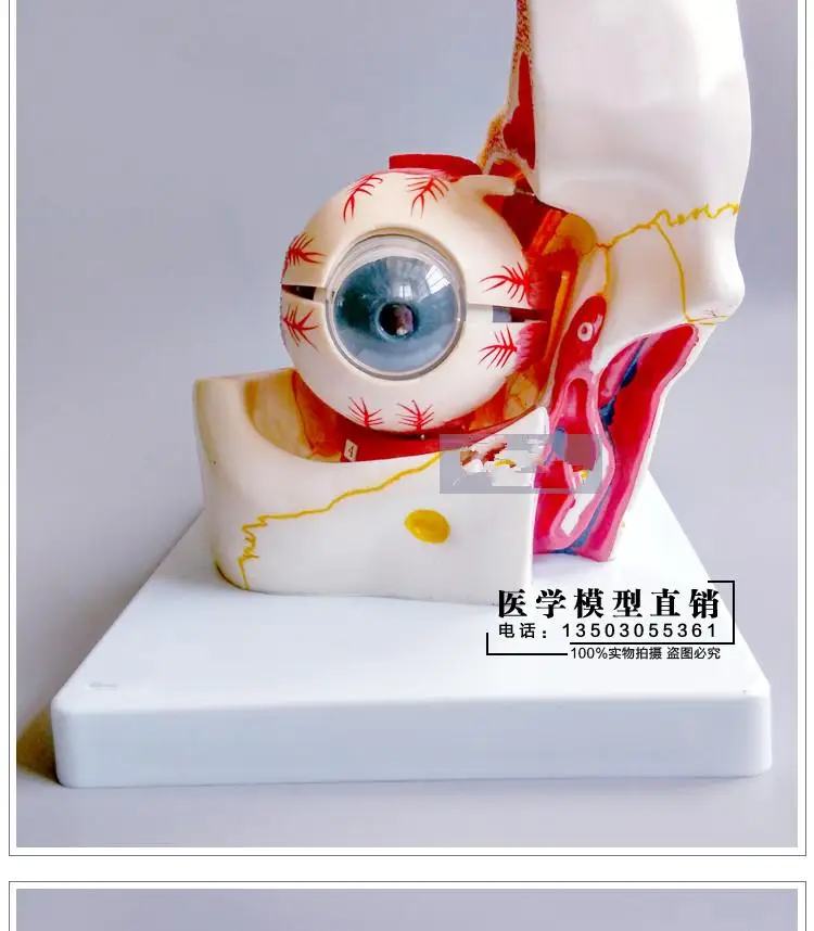 An enlarged anatomic model of the eye eye socket model  20*19*18cm  free shopping