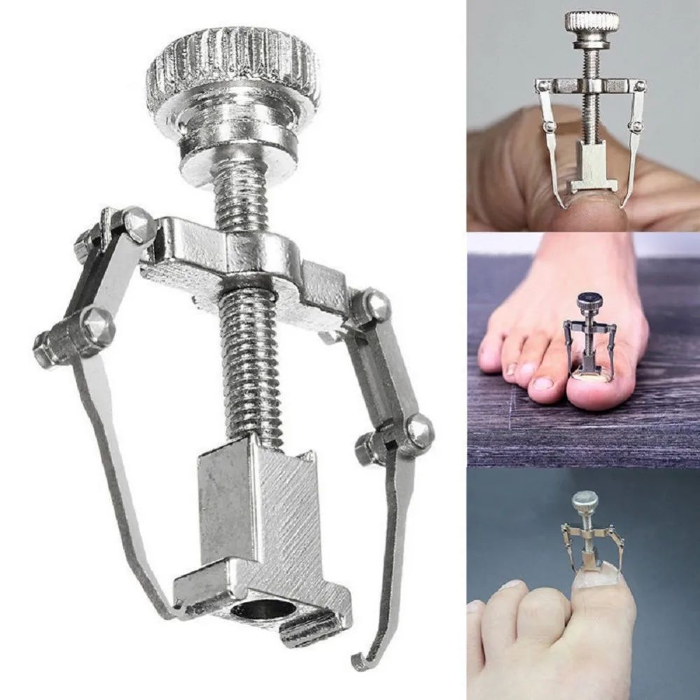 1 шт. инструмент для коррекции вросших пальцев ногтей фиксатор восстановления