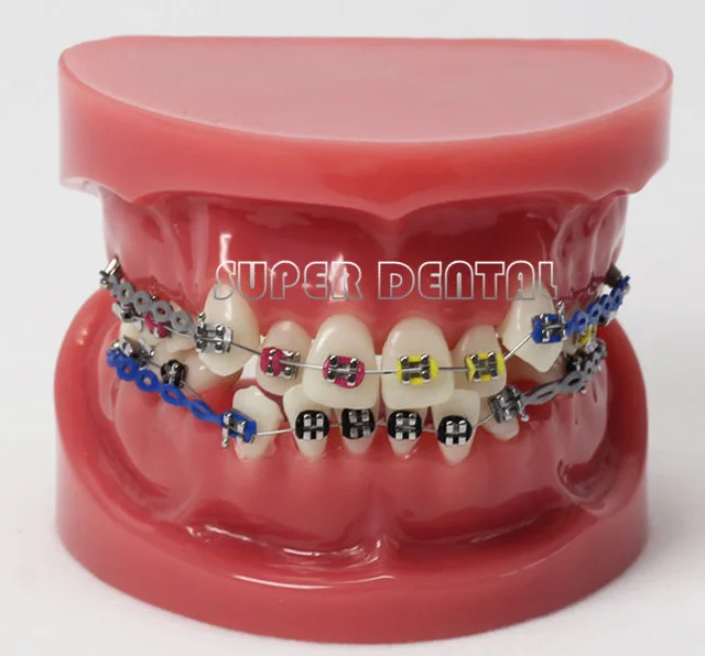 

teeth Orthodontic Model Bracket arch wire with wax dental model tooth model with metal brace free shipping