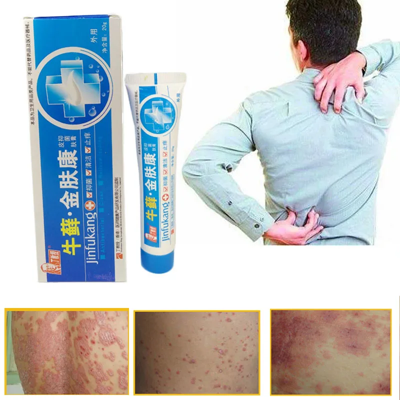 100% оригинальная мощная профессиональная мазь для лечения псориаза оригинал из