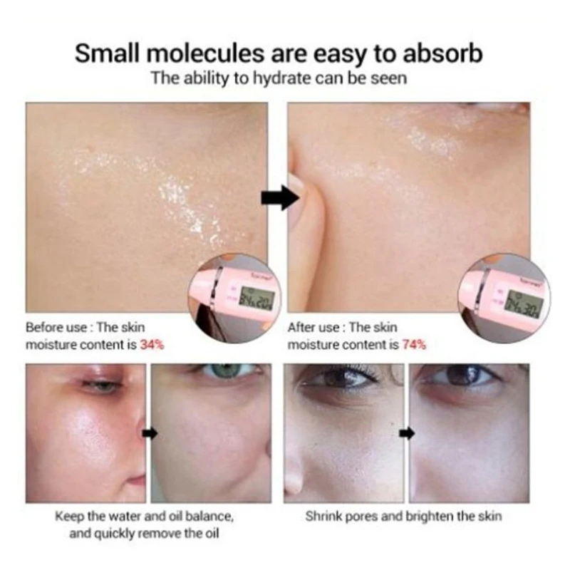 15 мл Сакура Гиалуроновая кислота для удаления пор акне жидкая увлажняющая