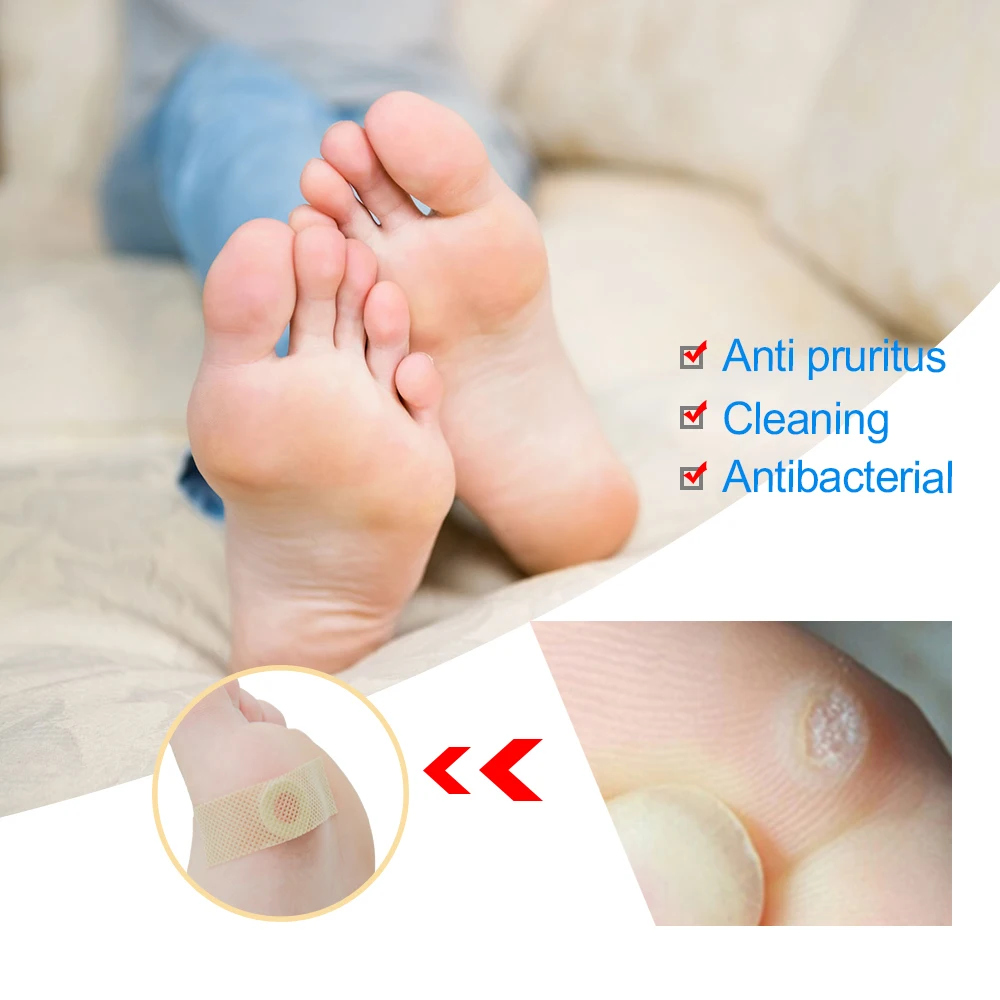 42pcs/box Foot Corn Removal Pain Patch Treatment Calluses Plantar Warts Thorn Toe Protectors Stickers Care Medical Plaster | Красота и