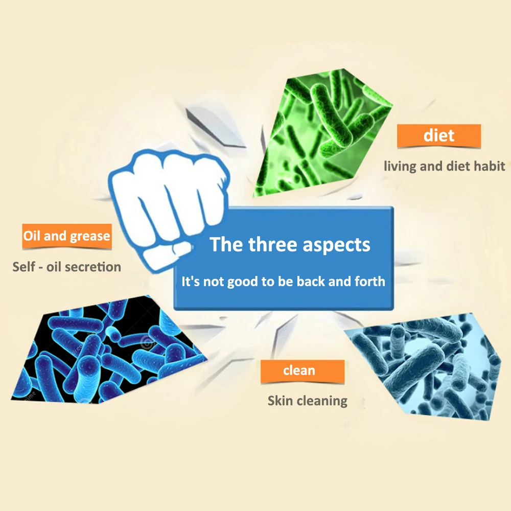 2 упаковки красным носом мазь от черных точек из черной Китайский травяной