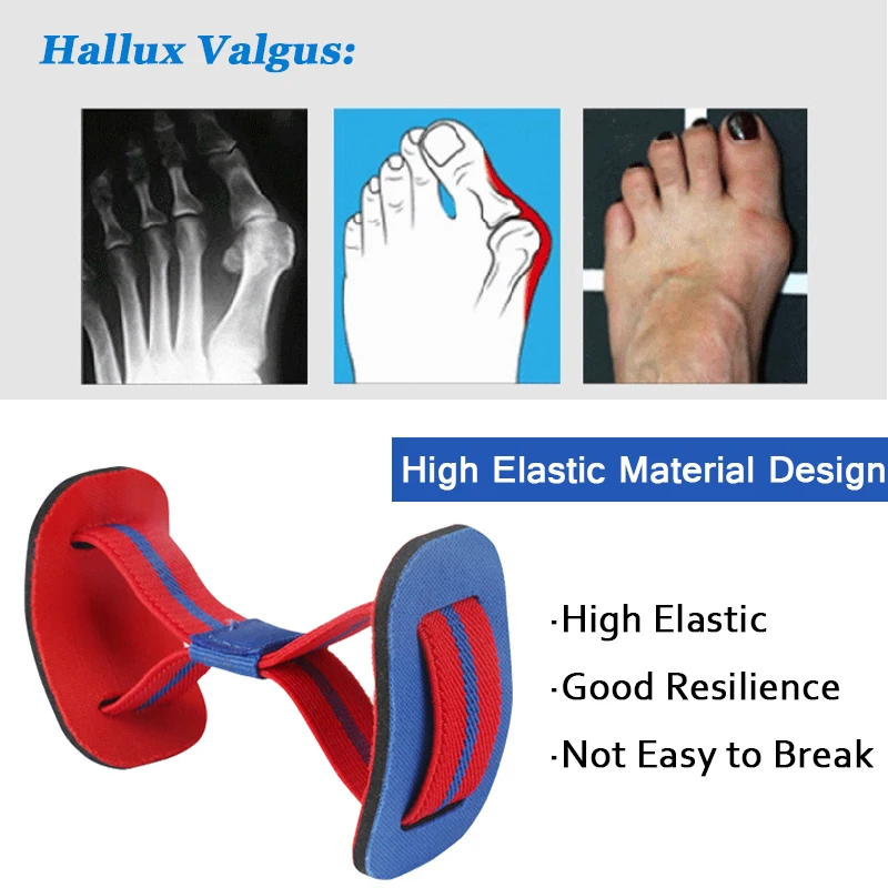 Leyou Hallux Valgus Corrector Foot Care Toe Separator Belt Toe Bunion Corrector Straightener Big Toe Stretcher Separators