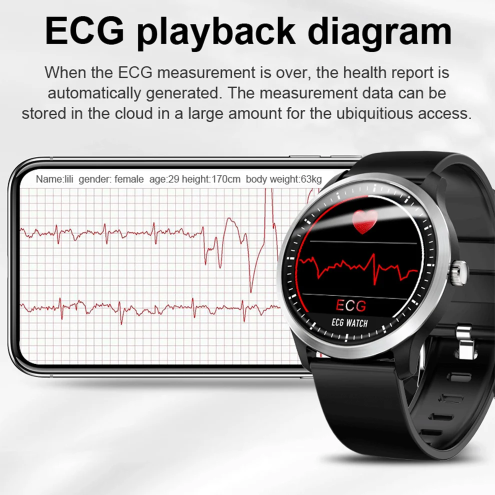 Смарт-часы SeenDa ECG PPG с электрокардиографическим дисплеем Холтер пульсометр