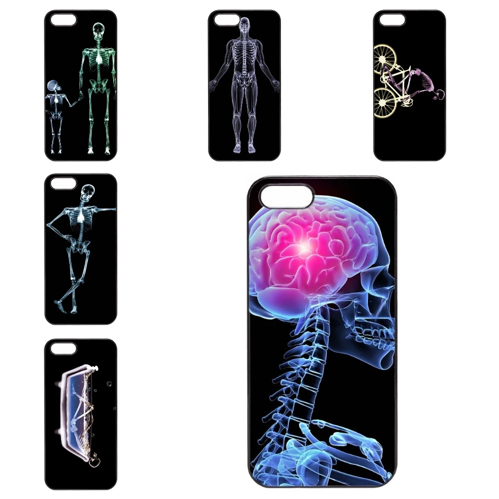 X Ray Скелет Для Asus ZenFone 2 3 ZE552KL 5 6 Лазерный ZE550KL Selfie Go Телефон Дело|phone cases|selfie phone caseselfie
