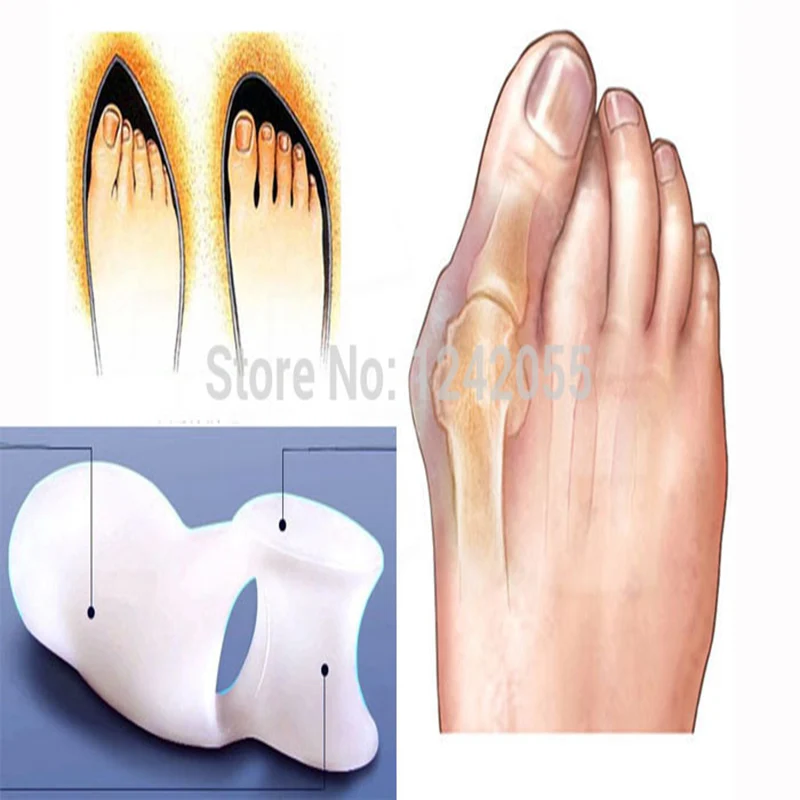 Лидер продаж профессиональный уход за ногами при вальгусной деформации массажер