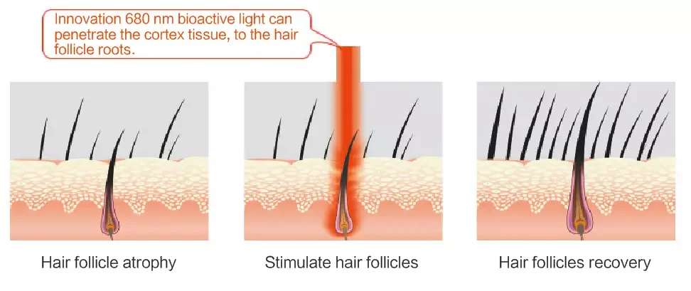 Новейший лазерный шлем для восстановления волос 150 медицинские диоды лечение