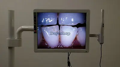 Стоматологическая 8 светодиодный Интраоральная Камера с 17 &quotЖК дисплей монитор