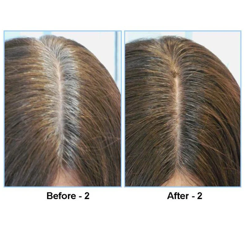 Hair Line Shadow Powder, Root Concealer, Fluffy Thin Hair Makeup, Instant Gray Coverage, 4g image 5
