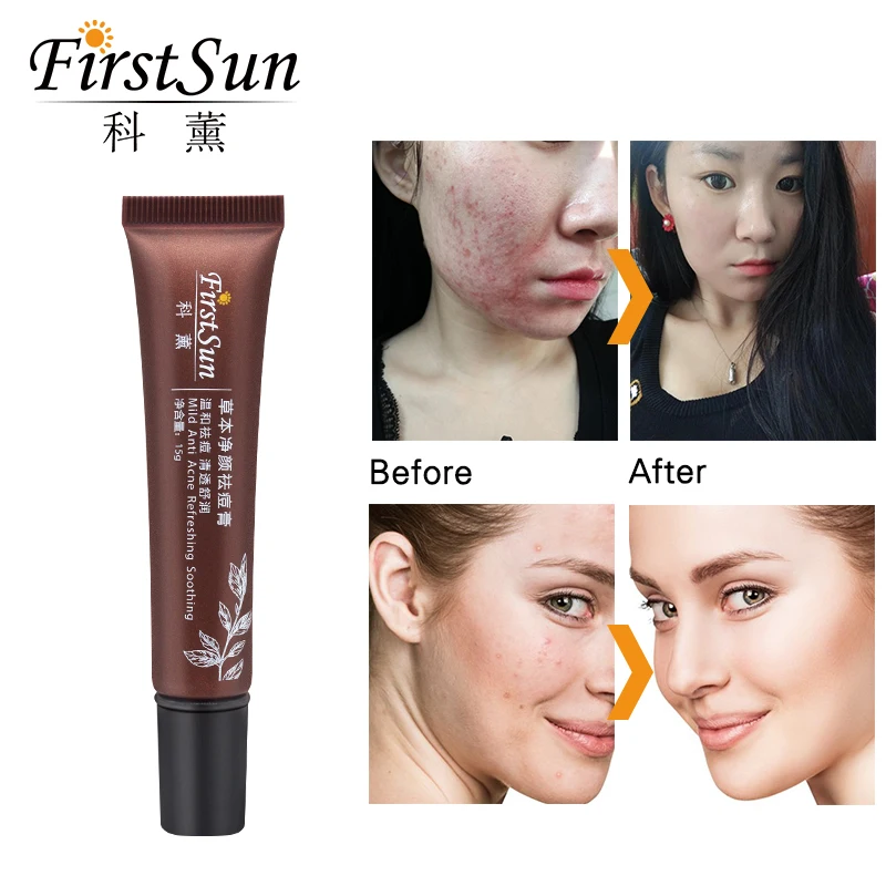 Firstsun Melasma кремовый дефект удаление сыворотки акне шрамы лечение прыщей патч Agless