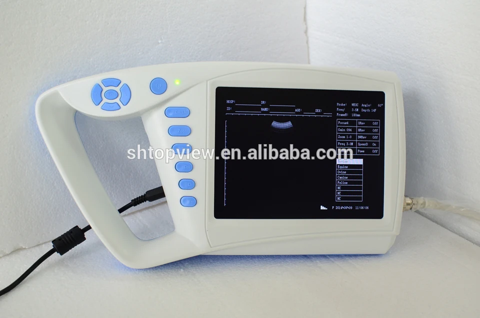 Ecnomic ATNL51353C полный цифровой Palmtop человек ветеринар многофункциональный 7 дюймов ручной портативный сканер