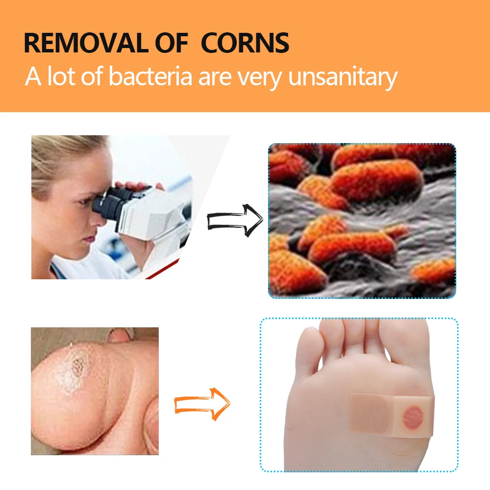 Sumifun семья Применение 30 шт./5 коробки ног кукурузы Remover ful мозолей Cure