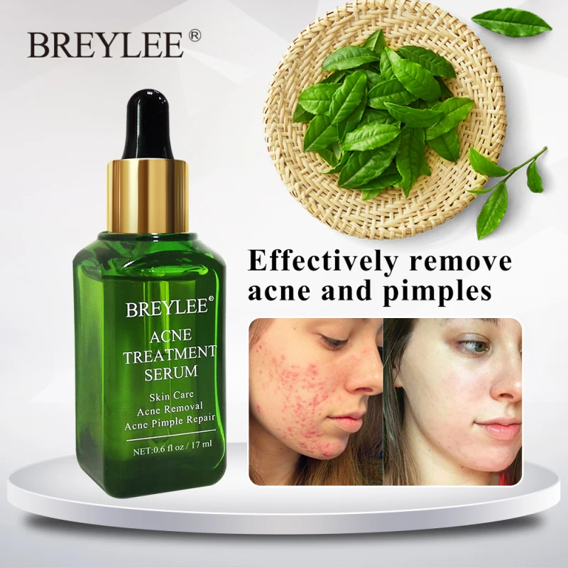 

1Pc 17ml Green Tea Essence Acne Treatment Serum Facial Anti Acne Scar Removal Skin Care Pimple Remover Repair Serum Liquid TSLM1