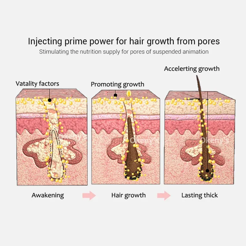 

Hair Growth Essence Spray Growth Oil Preventing Baldness Anti Hair Loss Hair Care Nourishing Enhancing Hair Roots