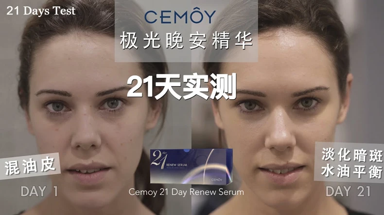 Cemoy 21 день обновление сыворотка 2 мл X 21 пачки лицо Ночная сывороточная эссенция Reapir дневные повреждения