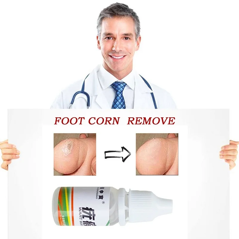 Body Warts Treatment Cream Skin Tag Remover Foot Corn Removal Plantar Genital Warts Ointment Foot Care Cream 10ML