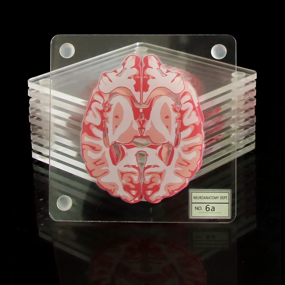 Мозговые образцы подставки набор 3D органные мозговые работы мозговые ломтики квадратная акриловая стеклянная подставка под стол для напитков подарок пьянским учёным