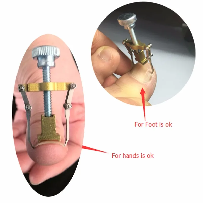 Устройство для фиксации вросших ногтей Adomaner ортопедический носок