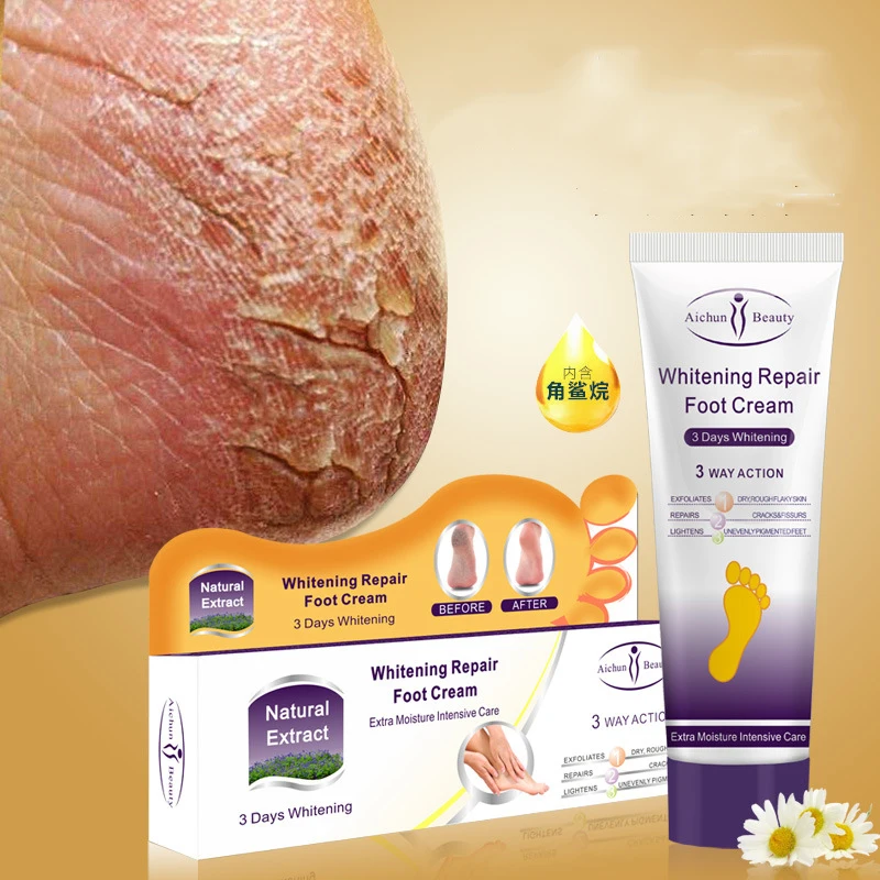 Крем пилинг Aichun для восстановления кожи пяток и рук 100 г|feet care cream|feet creamskin |
