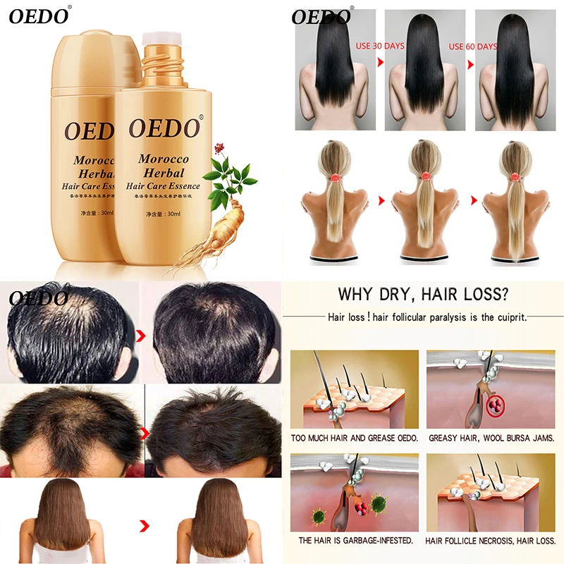30 мл oedo бренд Уход за волосами Марокко EssenceHair рост Сыворотки ремонт корни волос корень женьшеня лечение облысения Быстрый мощный