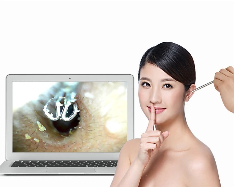 Otoscope Medical optic USB Digital Ear Endoscope Camera OtoscopeHigh power Image Monarch Processor tool | Безопасность и защита