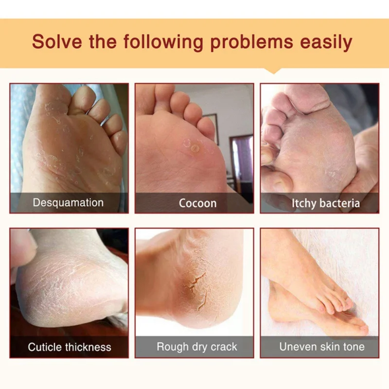 

Lavender Foot Mask Exfoliating Renewal Pedicure Remove Dead Skin Heel Socks Peeling Feet Mask