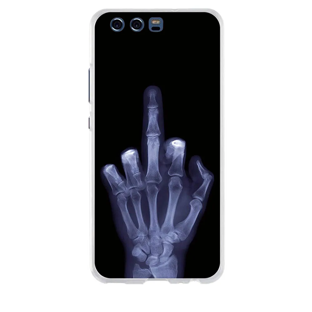 Чехол для huawei P10, чехол, силиконовый, 3D, мягкий, TPU, задняя крышка для huawei P10 P 10, чехол, Капа, Coque Funda, для huawei P10, чехол для телефона - Цвет: 19
