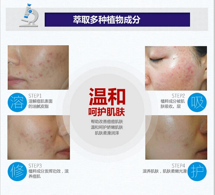 

500pcs FedEx BIOAQUA Pure Skin Acne Cream Light Print Scar Removal Face Cream Whitening Facial Skin Care Blemish Cream