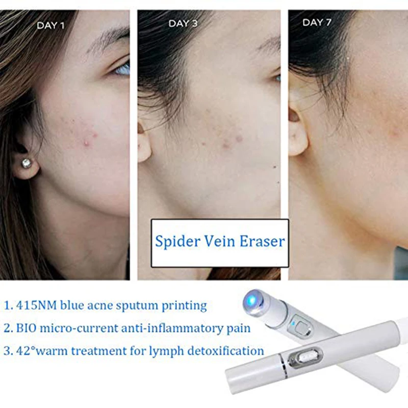 Портативная лазерная ручка для удаления угревой сыпи от шрамов морщин терапия
