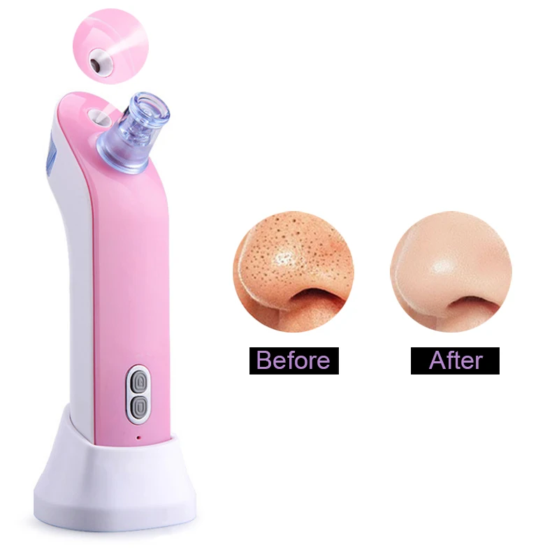 2в1 вакуумный отпариватель для удаления угрей лица прибор использует консилер