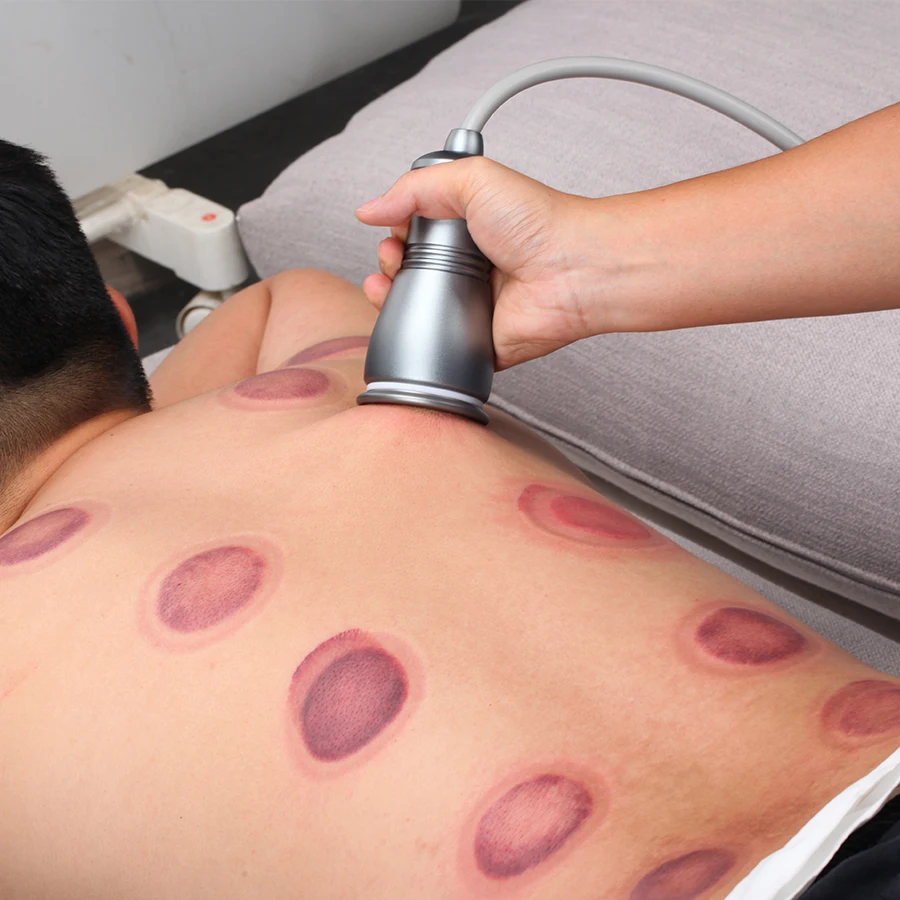 Электрическая Очищающая машина Gua Sha Ventosas антицеллюлитная горелка для жира