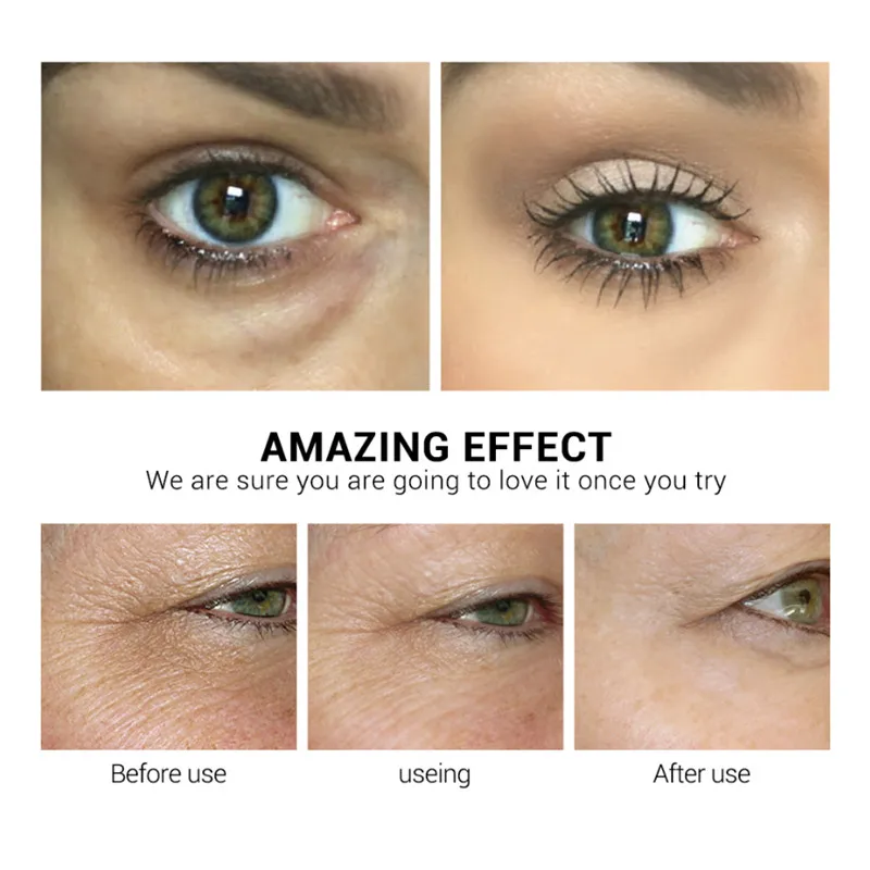 LANBENA маска для глаз Retinol, гиалуроновая кислота, сыворотка для глаз, уменьшает темные круги, мешки, морщины у глаз восстанавливающий, увлажняющий подтяжка кожи уход за кожей