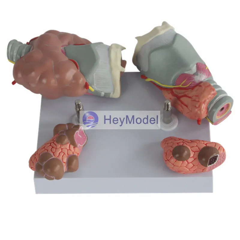 HeyModel щитовидная железа модель патология эндокринной болезни дисплей модели|display