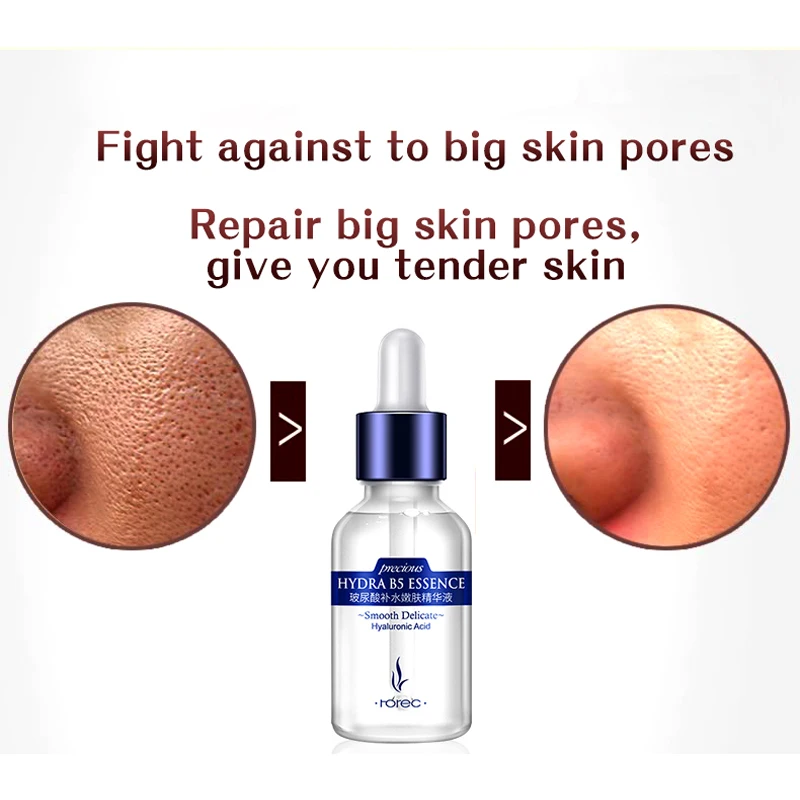 Сыворотка Rorec для лица с гиалуроновой кислотой эссенция уход за кожей сывороткой сужение пор против