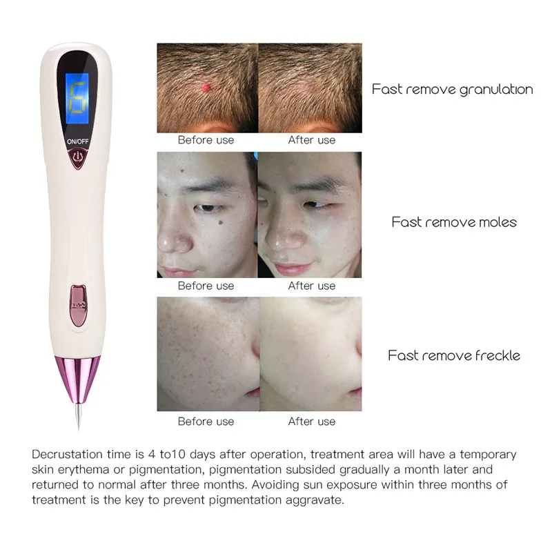 Elettrico portmacmacchie Lentiggine Nevo Verruca Talpa Rimozione Del Tatuaggio ручка ЖК-дисплей Dispositivi Alimentati Bellezz